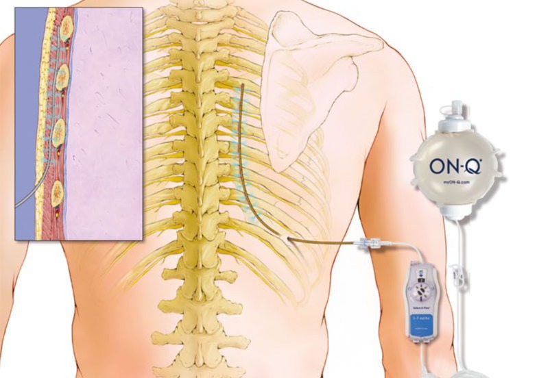 Odoo • Image and Text