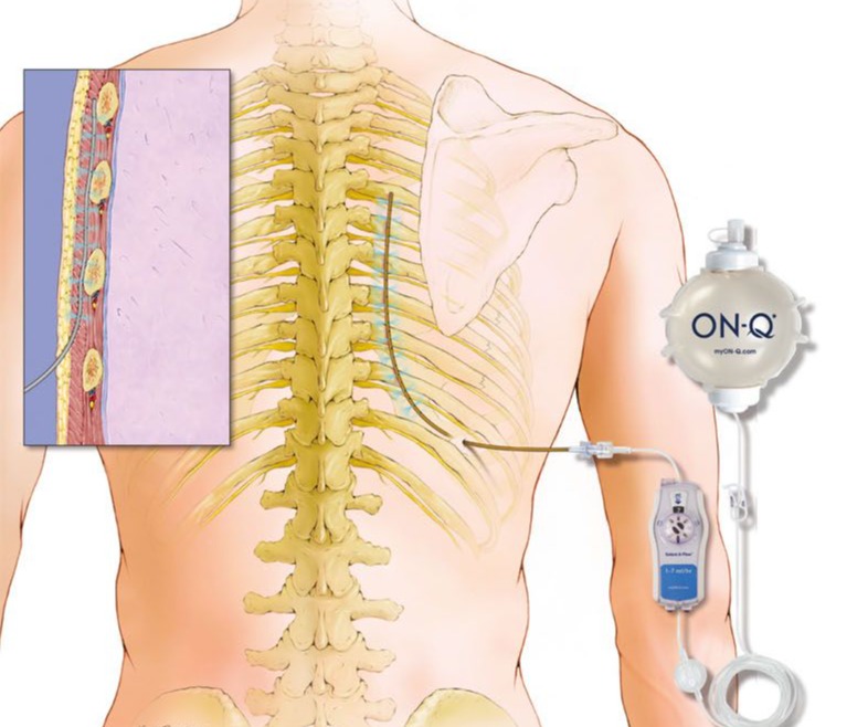 Odoo • Image and Text