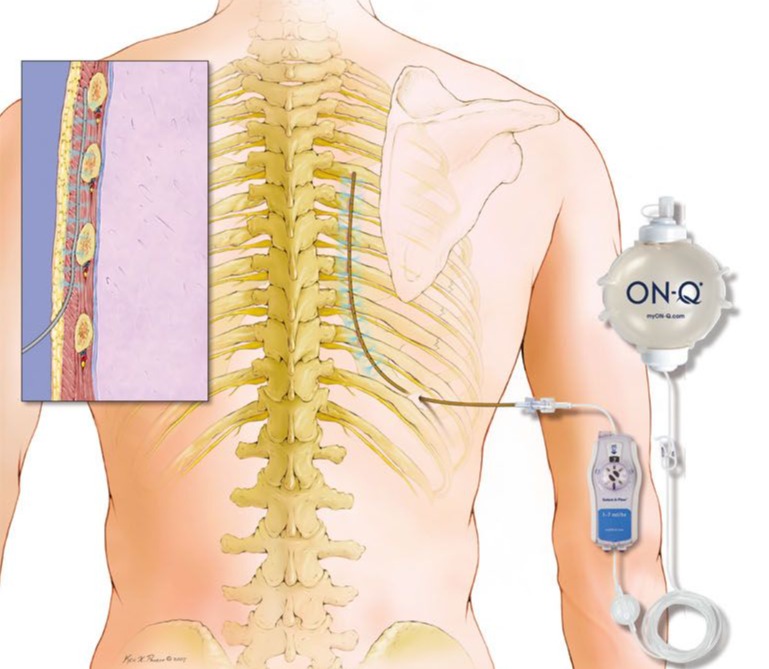 Odoo • Image and Text