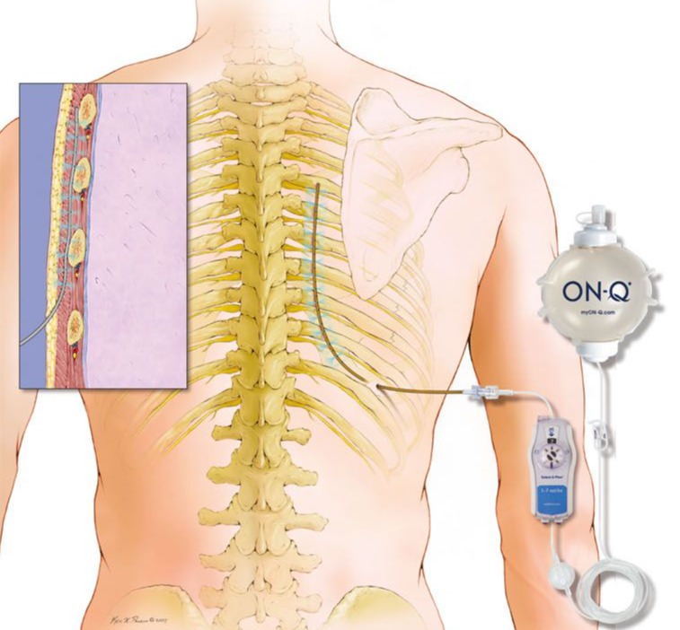 Odoo • Image and Text